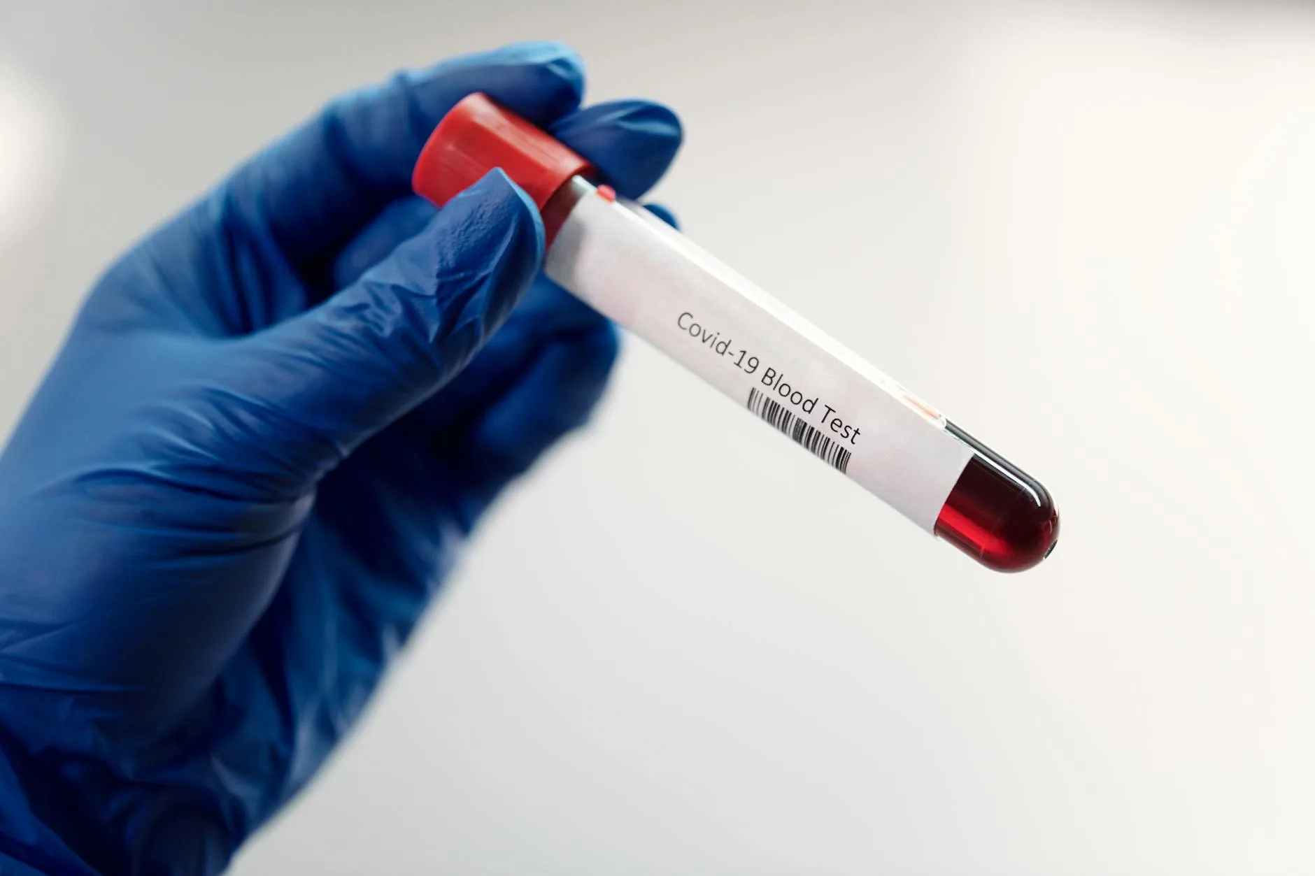 Medical professional holding Covid-19 blood test sample in laboratory, highlighting healthcare research.